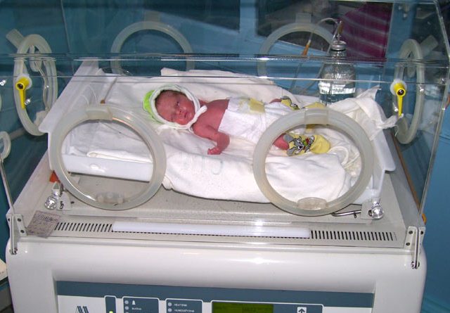 Что такое кювез для новорожденных фото
