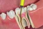 Инновационные и традиционные методы лечения зубов